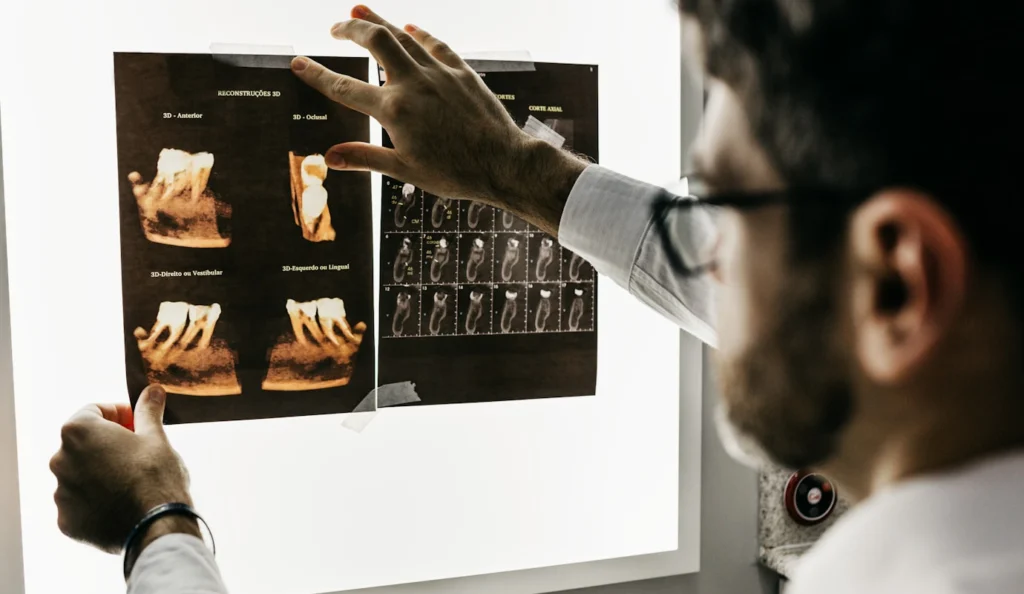 endodontie au cabinet dentaire à Villié Morgon