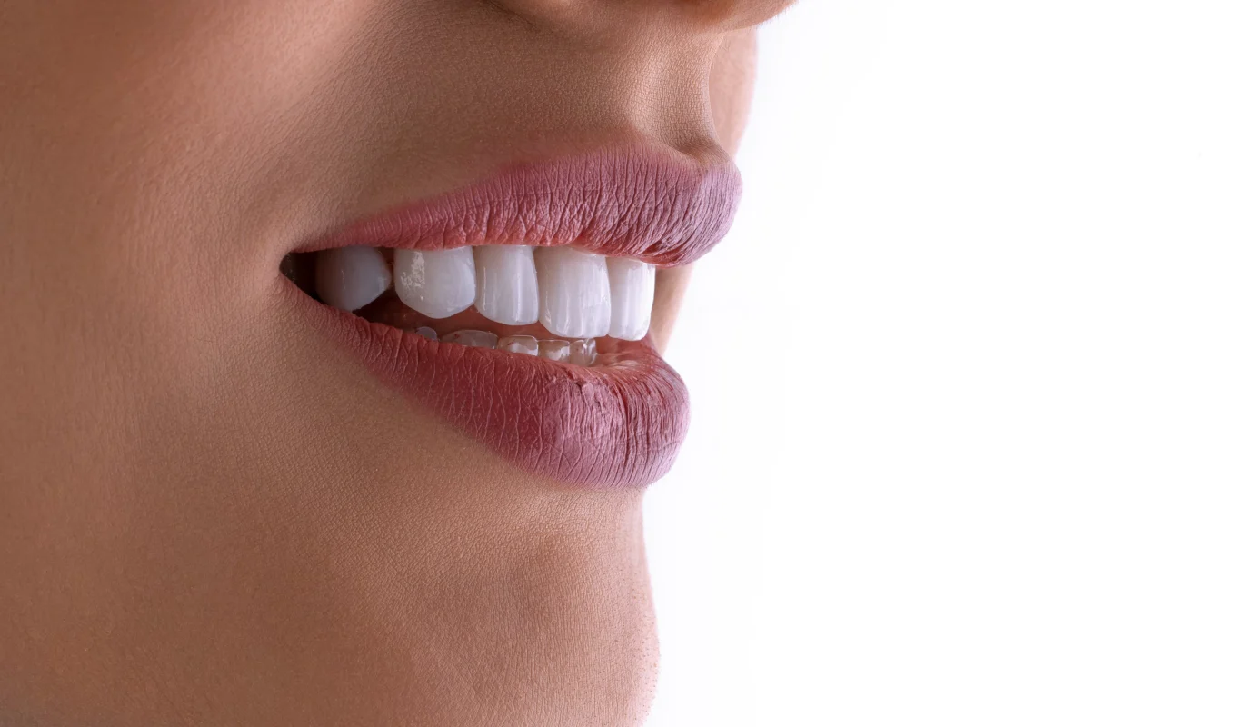 esthetique au cabinet dentaire à Villié Morgon