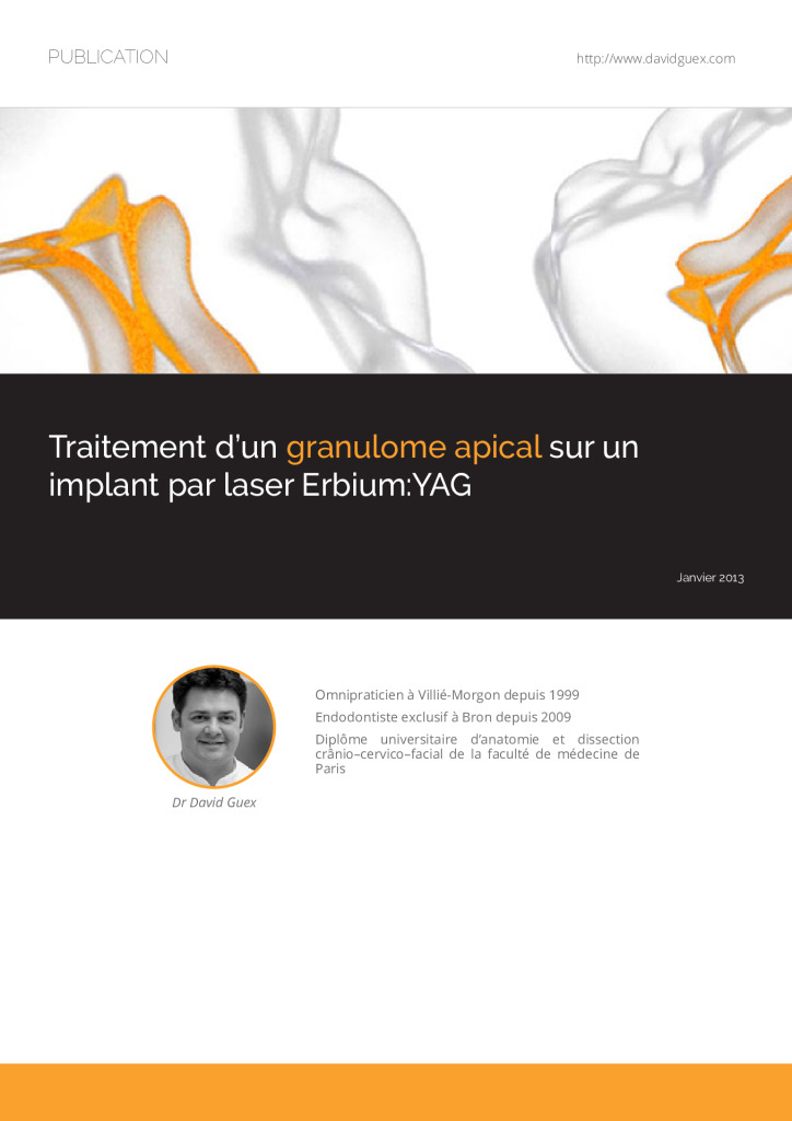thumbnail of dguex-201301-traitement_granulome_apical