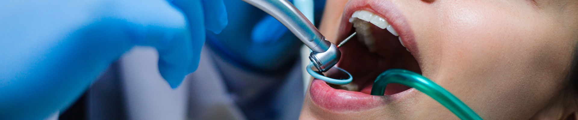 Endodontie au cabinet dentaire à Villié Morgon