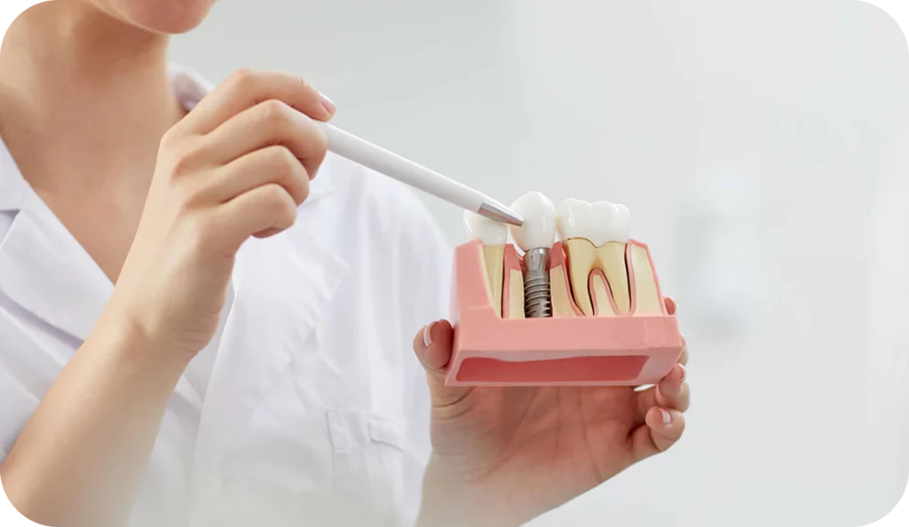 Extraction implantation immédiate