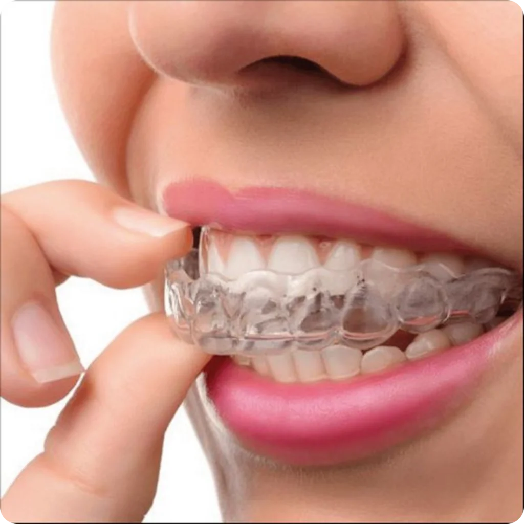 Recommandations pour l’entretien de votre hygiène buccale