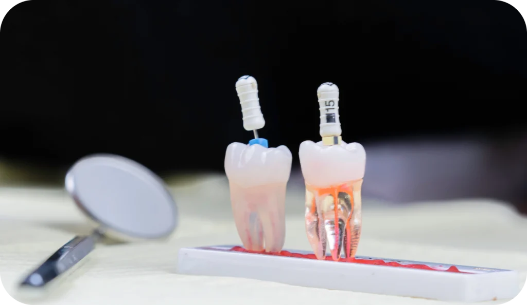 Reprise de traitement