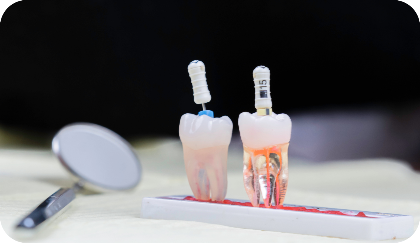 Reprise de traitement au cabinet dentaire à Villié Morgon